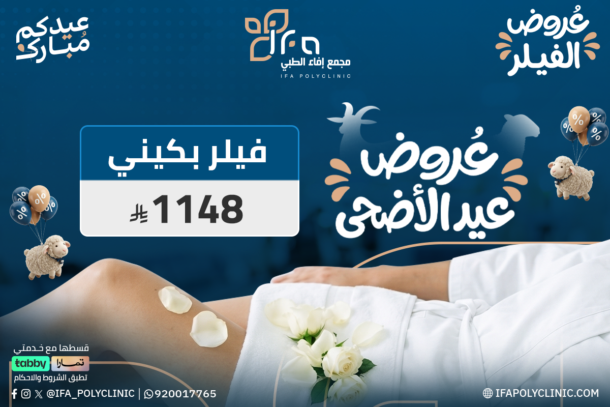 عروض الليزر 